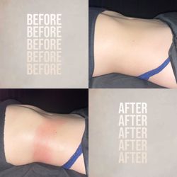 The Tox Scottsdale - Before & after treatment