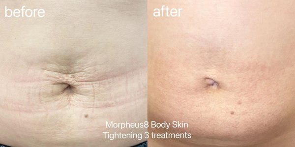 Beverly Hills Rejuvenation Center Westlake Village by null