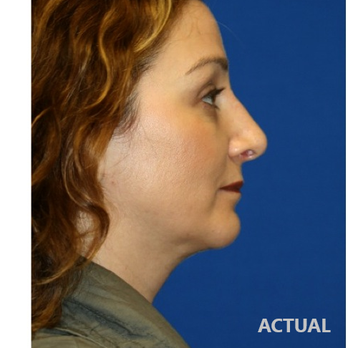 Amir M. Karam, M.D - Plastic Surgeons Near Me - San Diego, California