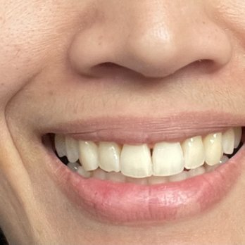 Matt Nashed, DDS - Long Beach Orthodontist Children's Dentistry - After - Orthodontists Near Me - Long Beach, California Matt Nashed, DDS - Long Beach Orthodontist Children's Dentistry - After - Orthodontists Near Me - Long Beach, California