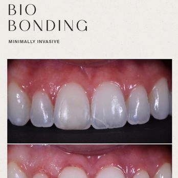 Les Belles - General Dentistry Near Me - New York, New York Les Belles - General Dentistry Near Me - New York, New York