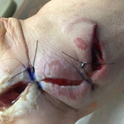 Christian Hand Center - Ok this was how it looked yesterday. And it is wrapped up just like this.
