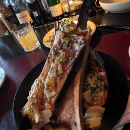 Bone marrow Bone marrow