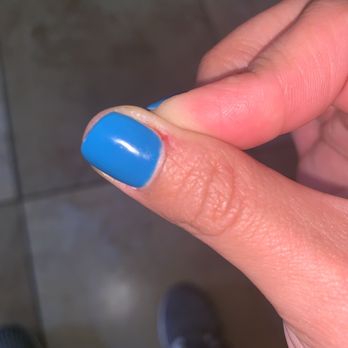 Sandy Nail Spa - This is my right thumb where she snipped it with the cutters to cut the cuticle - Nail Salons Near Me - Norwalk, California