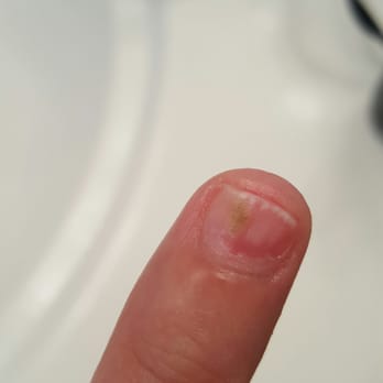 Bella Nails & Spa - I am super sad to have spent over $150 in two visits to discover fungus on one of my nails. - Nail Salons Near Me - Brea, California
