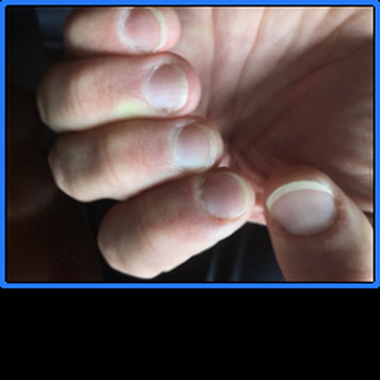 Life Upgrade 4 U - Chris C's nails! :) - Hypnosis/Hypnotherapy Near Me - Brea, California