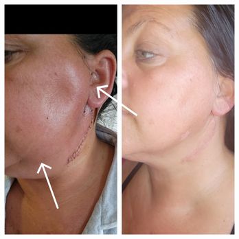 To Make Beautiful - lymphatic drainage - Makeup Artists Near Me - Stoneham, Massachusetts