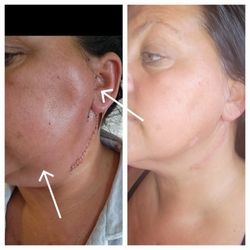To Make Beautiful - Lymphatic drainage