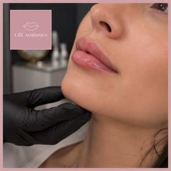 Lilli Aesthetics - Aestheticians Near Me - Mansfield, Texas Lilli Aesthetics - Aestheticians Near Me - Mansfield, Texas