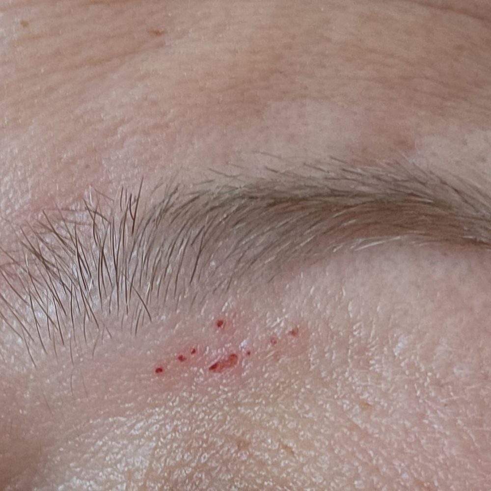 I Brow Bar Pinole - Skin removal below the eyebrow - Hair Removal Near Me - Pinole, California I Brow Bar Pinole - Skin removal below the eyebrow - Hair Removal Near Me - Pinole, California