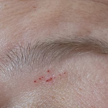 I Brow Bar Pinole - Skin removal below the eyebrow - Hair Removal Near Me - Pinole, California I Brow Bar Pinole - Skin removal below the eyebrow - Hair Removal Near Me - Pinole, California