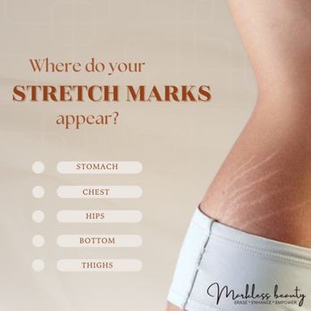 Markless Beauty - Tattoo Near Me - Hallandale , Florida Markless Beauty - Tattoo Near Me - Hallandale , Florida