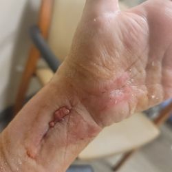 Southern California Orthopedic Institute - This was December 23 at the er.