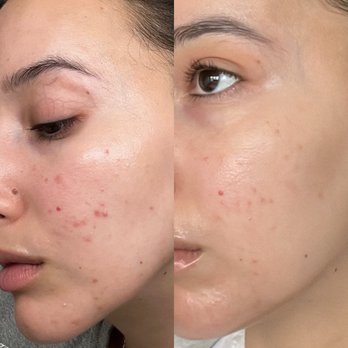 Arya Derm - Dermatologists Near Me - San Francisco, California