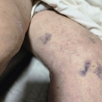DM Injury Law - Personal Injury Law Near Me - St. Louis, Missouri DM Injury Law - Personal Injury Law Near Me - St. Louis, Missouri