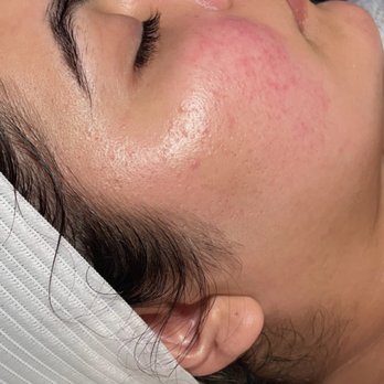 The Skin Resilience  - Skin Care Near Me - San Dimas , California