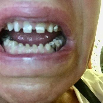 Beckelman Robert, DMD - ZERO REASON FOR THIS - General Dentistry Near Me - Garden City, New York Beckelman Robert, DMD - ZERO REASON FOR THIS - General Dentistry Near Me - Garden City, New York