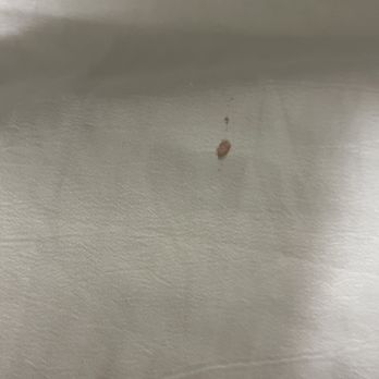 Hilton Garden Inn Jackson/Clinton - Blood stain in bed. - Hotels Near Me - Clinton, Mississippi Hilton Garden Inn Jackson/Clinton - Blood stain in bed. - Hotels Near Me - Clinton, Mississippi