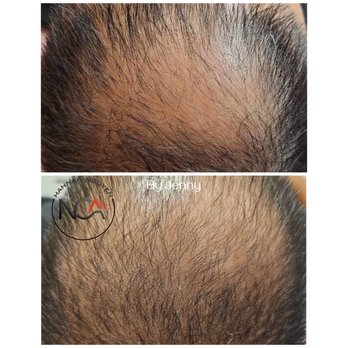 Ibrows N Lashes - Permanent Makeup Near Me - Orange, California Ibrows N Lashes - Permanent Makeup Near Me - Orange, California