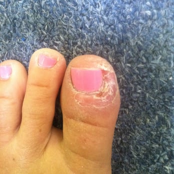 Nail Fervour - Does this cost extra? Disgusting fungus from the salon! - Nail Salons Near Me - Lawrenceville, Georgia Nail Fervour - Does this cost extra? Disgusting fungus from the salon! - Nail Salons Near Me - Lawrenceville, Georgia