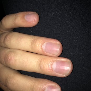 Moda Nail Spa - Cuticles are rough, absolutely no shape to the nails - Nail Salons Near Me - Knoxville, Tennessee Moda Nail Spa - Cuticles are rough, absolutely no shape to the nails - Nail Salons Near Me - Knoxville, Tennessee