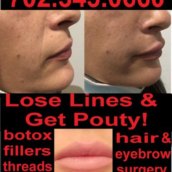 Phaze Laser Med Spa - phaze laser med spa in Summerlin, Las Vegas has weekly specials on facials, botox, lip fillers and more, call 7025450660 now! - Medical Spas Near Me - Las Vegas, Nevada Phaze Laser Med Spa - phaze laser med spa in Summerlin, Las Vegas has weekly specials on facials, botox, lip fillers and more, call 7025450660 now! - Medical Spas Near Me - Las Vegas, Nevada