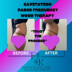 Freedom Kulture Esthetics - Before and after same day