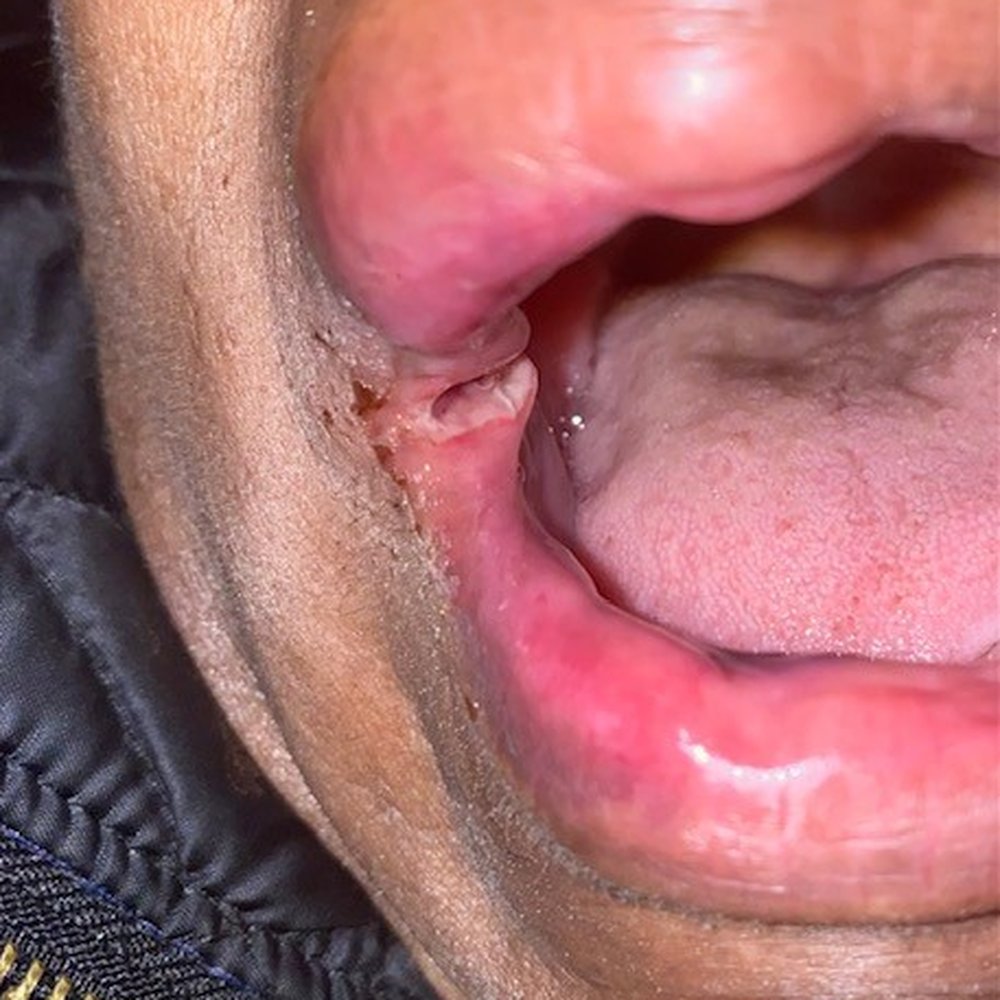 THIS HUGE GASH WENT UNNOTICED AND UNTREATED BY THE MEDICAL STAFF AT THIS EMERGENCY CENTER. THIS HUGE GASH WENT UNNOTICED AND UNTREATED BY THE MEDICAL STAFF AT THIS EMERGENCY CENTER.