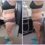 Photo of Total Image Master Body Sculpting