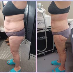 Total Image Master Body Sculpting - Loose inches burn fat faster Shape your Body 707-331-7983