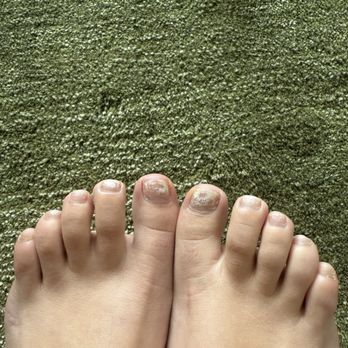 Milano Nail Spa - Toe fungus - Nail Salons Near Me - Austin, Texas