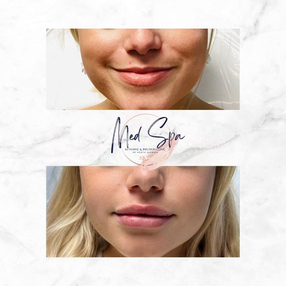 Ketamine Wellness Clinic of South Florida - grief counselor in Pompano Beach, FL