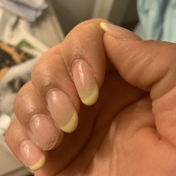Sensation Nail Spa - Dipped nails that keep cracking. Notice shorter nails and broken nails - Nail Salons Near Me - Rolling Hills Estates, California Sensation Nail Spa - Dipped nails that keep cracking. Notice shorter nails and broken nails - Nail Salons Near Me - Rolling Hills Estates, California