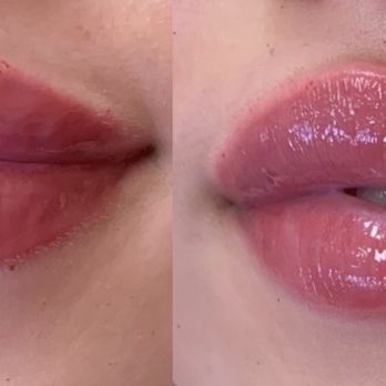 MM Aesthetics: Marina Musalyants, RN, MSN - Aestheticians Near Me - Brooklyn, New York