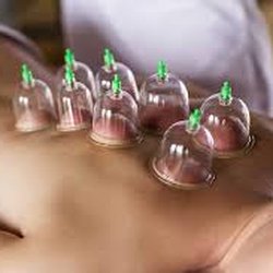 Angel's Aromatic Massage - New Athletic Cupping and Detoxing