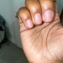 Davi Nails - Ive had to cut the nail away to treat the bacteria.