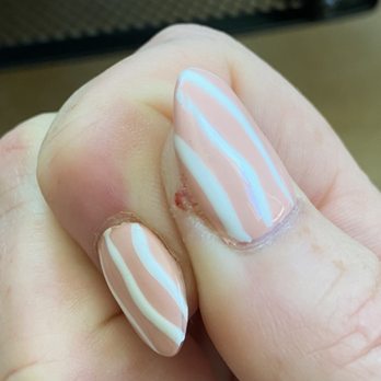 Q - Nails - Infection under my right thumbnail within a few days of appointment. - Nail Salons Near Me - Santa Maria, California Q - Nails - Infection under my right thumbnail within a few days of appointment. - Nail Salons Near Me - Santa Maria, California