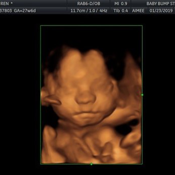 Baby Bump Studios  - Diagnostic Imaging Near Me - Ontario, California
