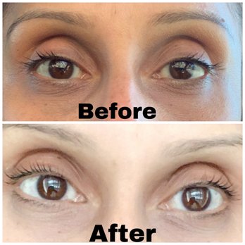 Elevated Aesthetic  - Lash Lift - Eyelash Service Near Me - Walnut Creek , California