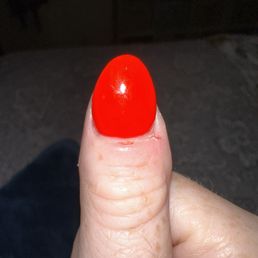 Nail cuticle cut up!
