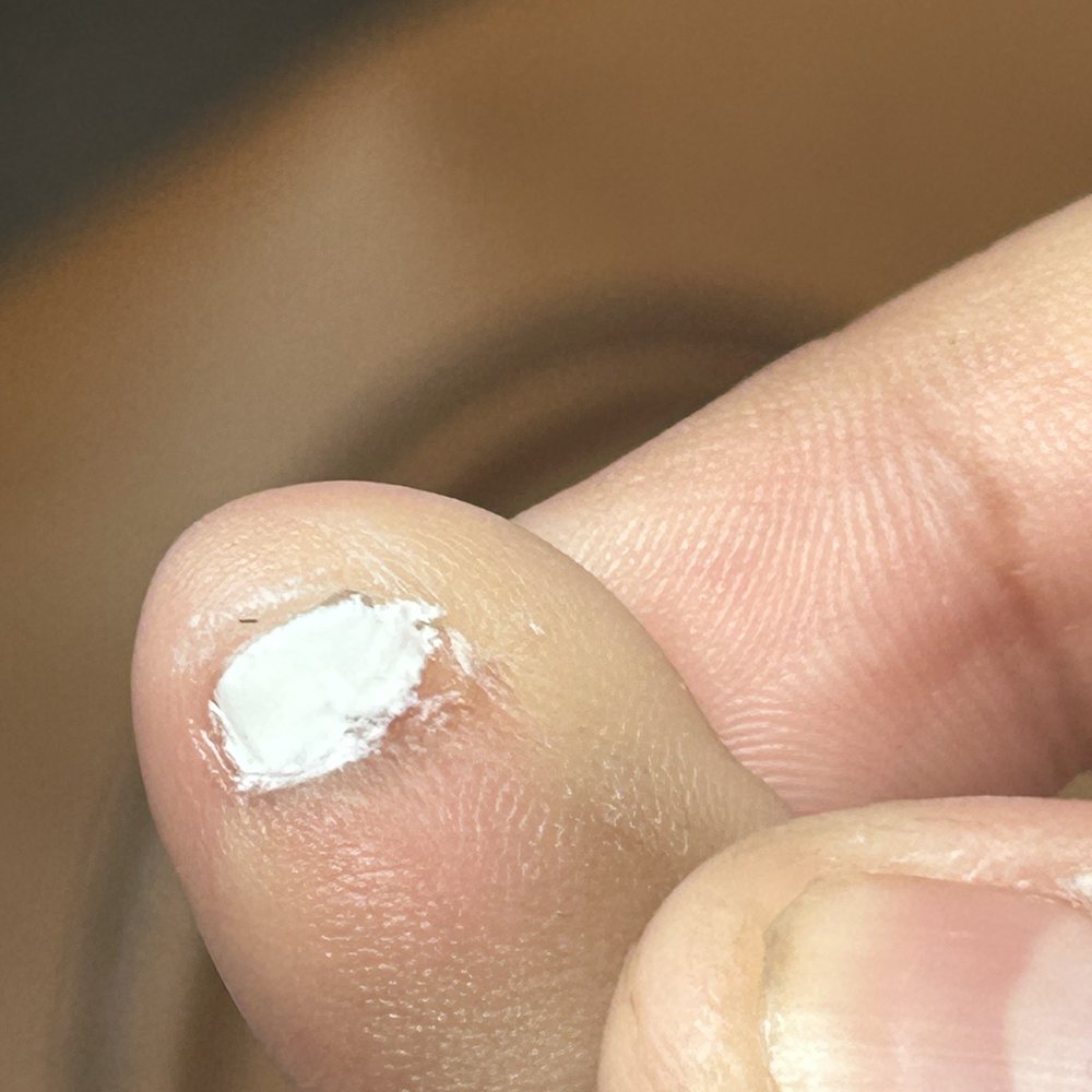 Pinky toe gel pedicure Pinky toe gel pedicure