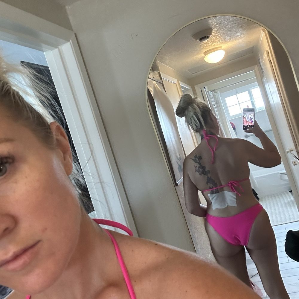 Gaon Plastic Surgery - Post op - Fat transfer to hip dips - Cosmetic Surgeons Near Me - Corona Del Mar, California Gaon Plastic Surgery - Post op - Fat transfer to hip dips - Cosmetic Surgeons Near Me - Corona Del Mar, California