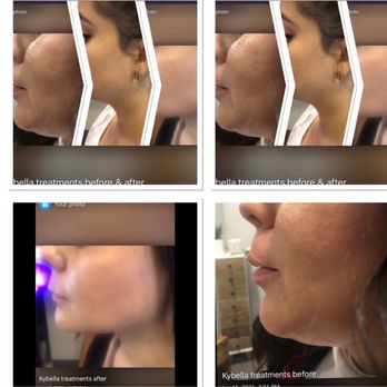 Peachy Skin Care - Medical Spas Near Me - Davis, California Peachy Skin Care - Medical Spas Near Me - Davis, California