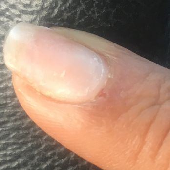 Nail 7 - Aggressive on cuticles - Nail Salons Near Me - Latham, New York