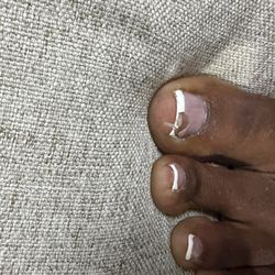 One of my toes