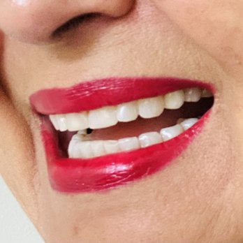 Haratz Dental - Smile - General Dentistry Near Me - Aventura, Florida