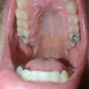 Aspen Dental - Lisbon, CT - Self - Oral Surgeons Near Me - Lisbon, Connecticut Aspen Dental - Lisbon, CT - Self - Oral Surgeons Near Me - Lisbon, Connecticut