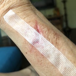 My torn skin from the camper shell fiberglass My torn skin from the camper shell fiberglass