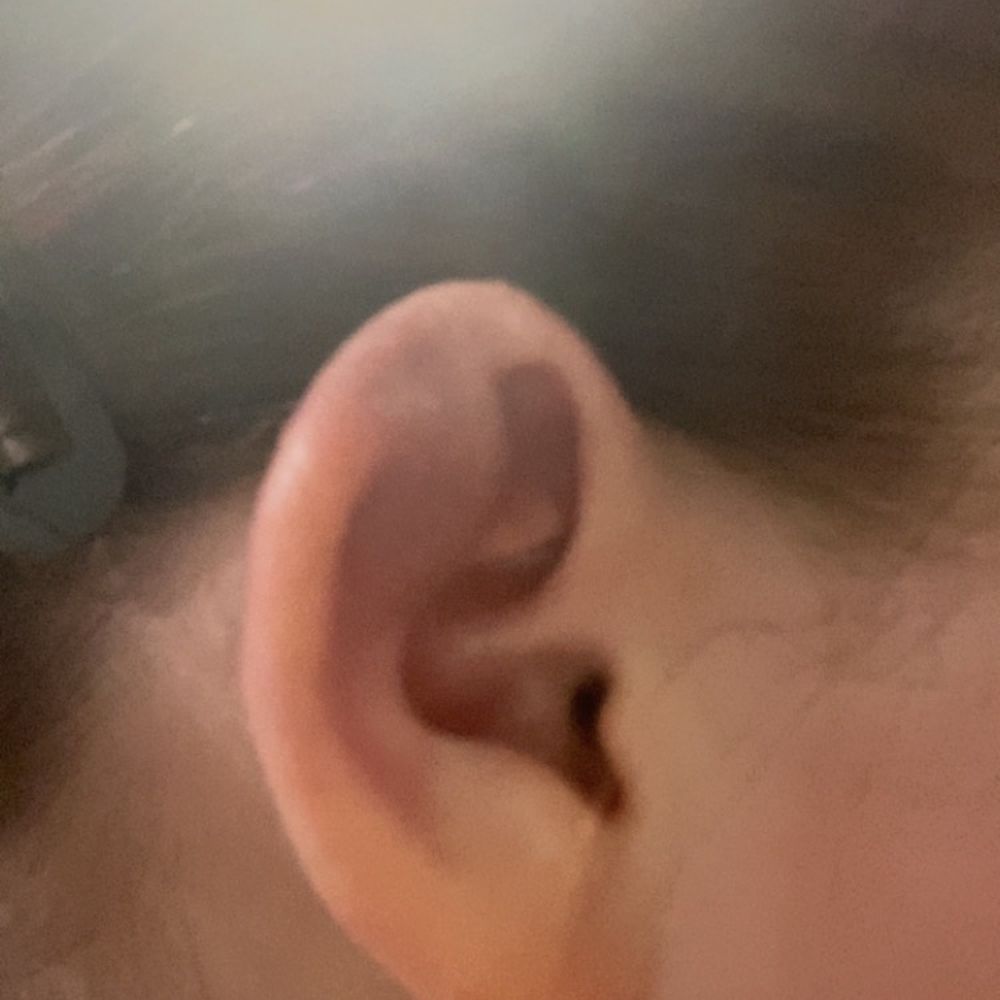 Medusa - This was yesterday - Piercing Near Me - Manchester, New Hampshire