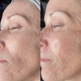 Bougie Aesthetics - Medical Spas Near Me - Fort Worth, Texas Bougie Aesthetics - Medical Spas Near Me - Fort Worth, Texas